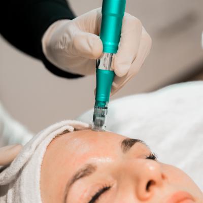 Microneedling